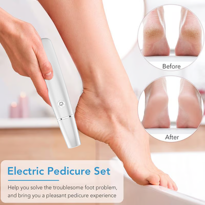 🎁Portable Electric Feet Callus Remover-Hjmeta®