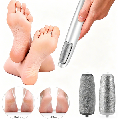🎁Portable Electric Feet Callus Remover-Hjmeta®