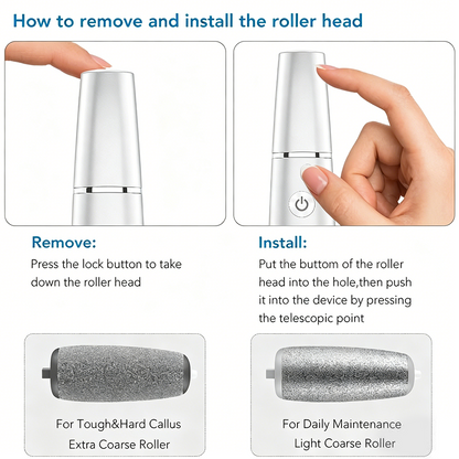 🎁Portable Electric Feet Callus Remover-Hjmeta®
