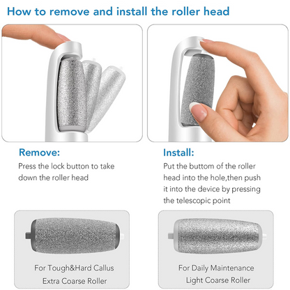 🎁Portable Electric Feet Callus Remover-Hjmeta®