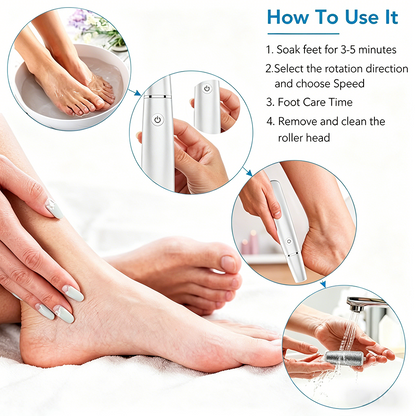 🎁Portable Electric Feet Callus Remover-Hjmeta®